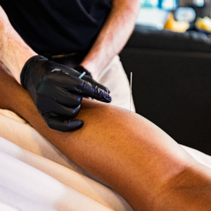 Dry Needling